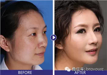 这个圣诞,你要冰雪冻人,还是美丽动人?